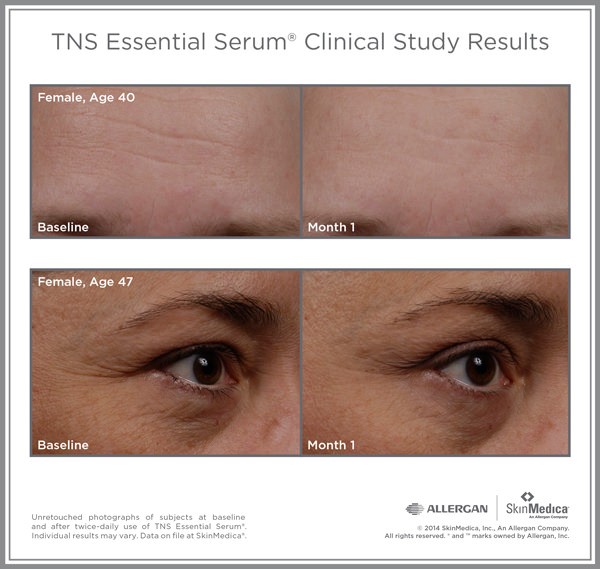 What is the most effective anti-aging product?