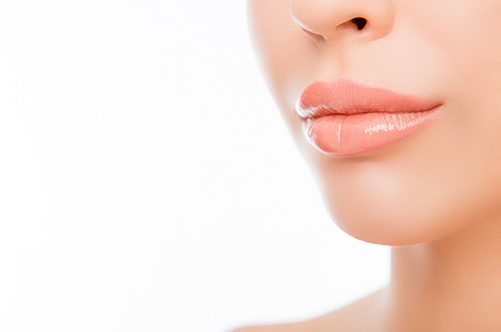 Volbella for a Natural Looking Lip Augmentation
