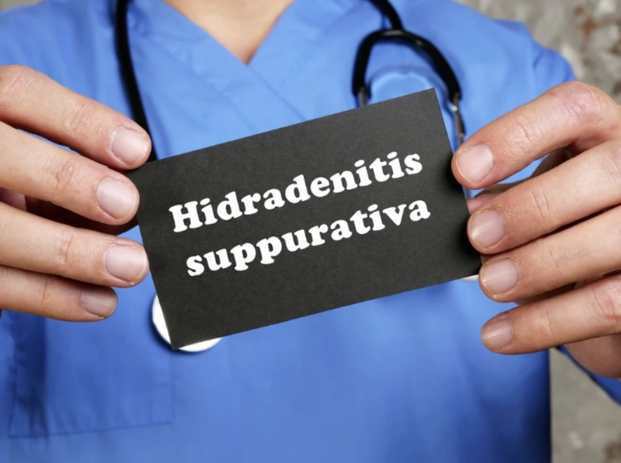 Common areas affected by Hidradenitis Suppurativa